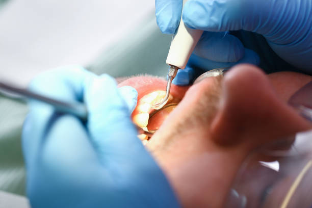 Dentist for Dental Trauma in IA